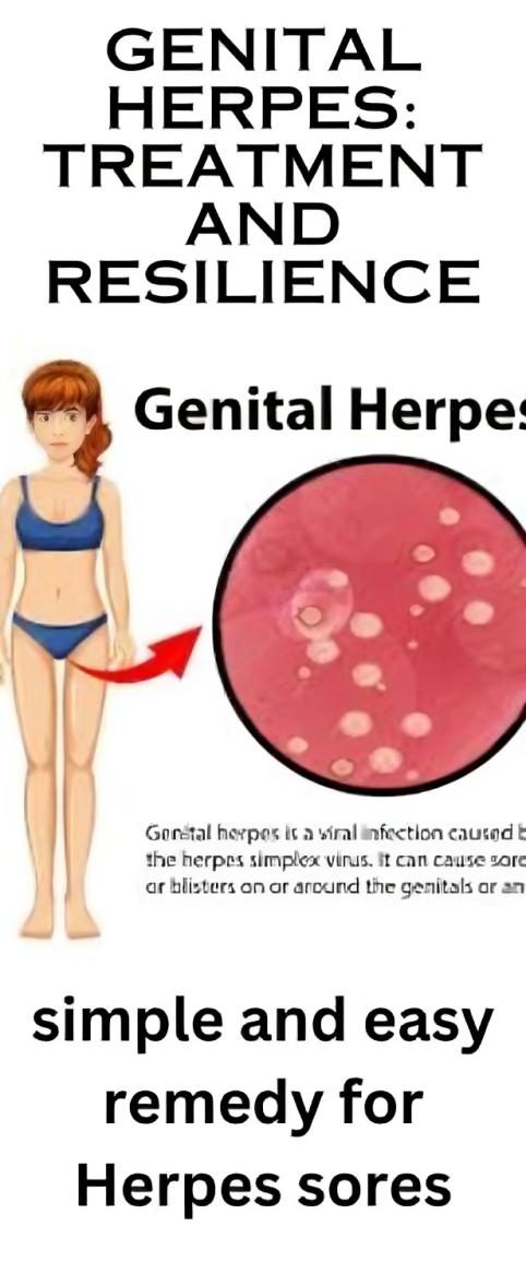 🌿 Natural Treatment for Genital Herpes: Herbal Support for Healing and Management 🌿