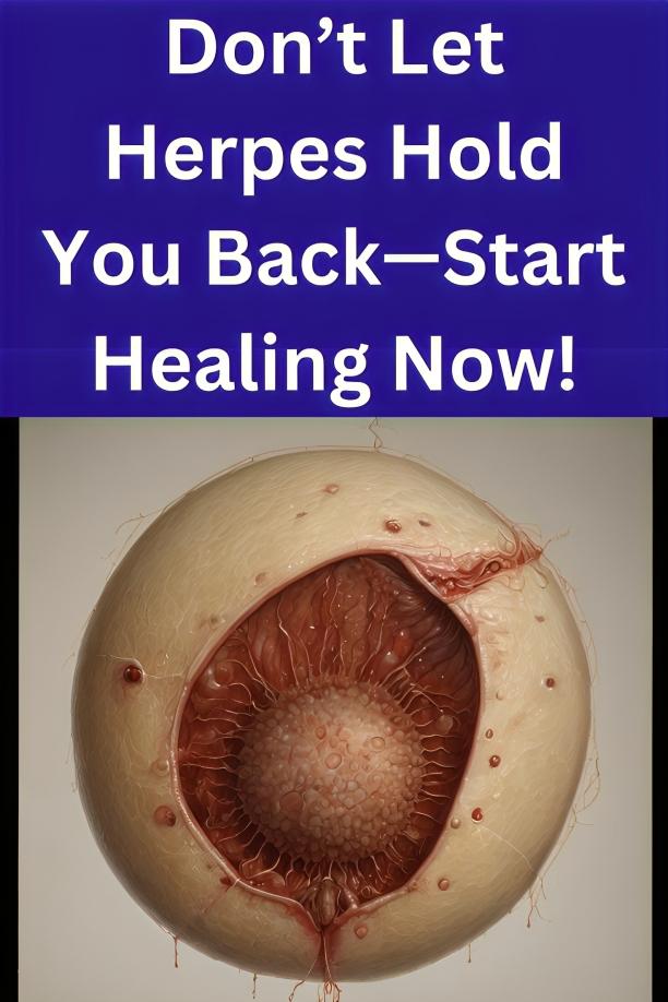 Don’t Let Herpes Hold You Back — Start Healing Today with Herbs
